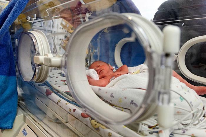 Dünyada her yıl 15 milyon bebek erken doğuyor