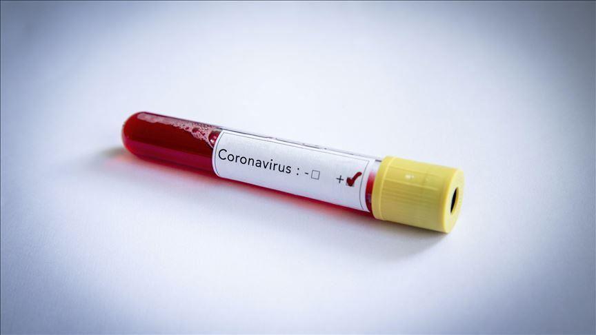 Bakan Varank müjdeyi verdi: Corona virüse karşı yerli ilaç üretildi